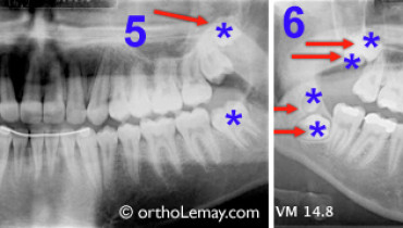 exemple de sagesse 5 lettres